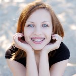 Pretty girl wearing braces smiling cheerfully